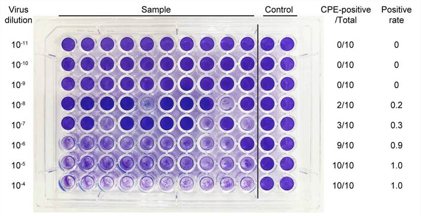 Infectious Viral Titer Testing Creative Diagnostics